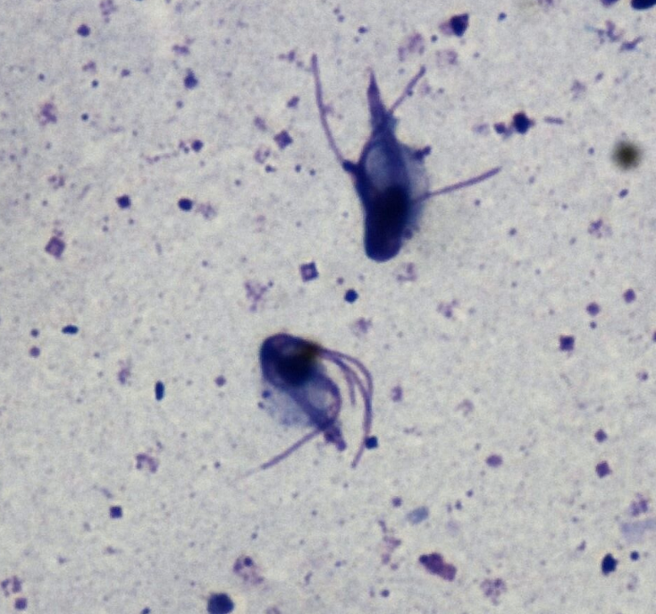 Microscopic view of Tritrichomonas foetus, a parasite relevant in treating Tritrichomonas in cats